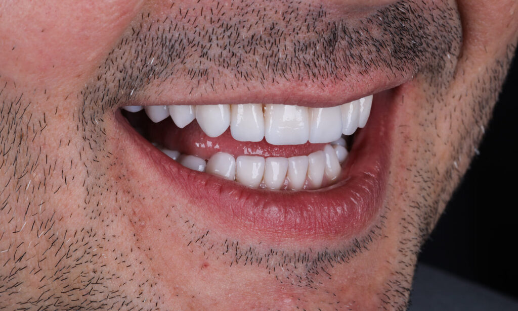 3I0A4657